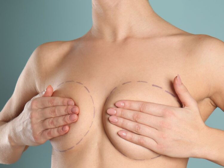 Mastopexia: Cirurgião plástico fala como esta cirurgia pode melhorar seus seios