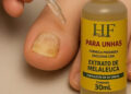 HF Pharma revela: Até 80% dos brasileiros podem ter micose nas unhas e a maioria nem desconfia