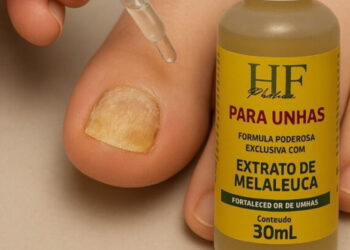 HF Pharma revela: Até 80% dos brasileiros podem ter micose nas unhas e a maioria nem desconfia