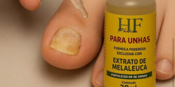 HF Pharma revela: Até 80% dos brasileiros podem ter micose nas unhas e a maioria nem desconfia