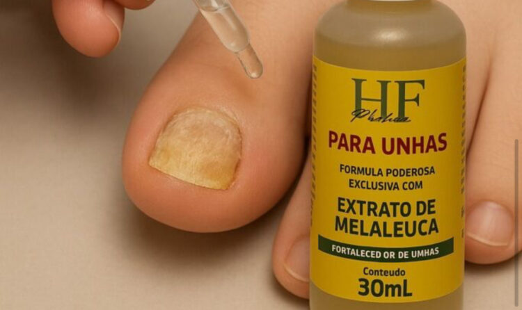 HF Pharma revela: Até 80% dos brasileiros podem ter micose nas unhas e a maioria nem desconfia